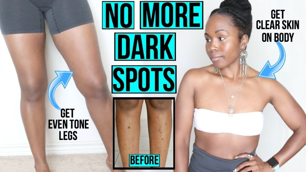 how to remove black skin in between thighs