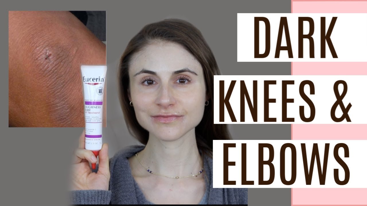 best lotion for elbows