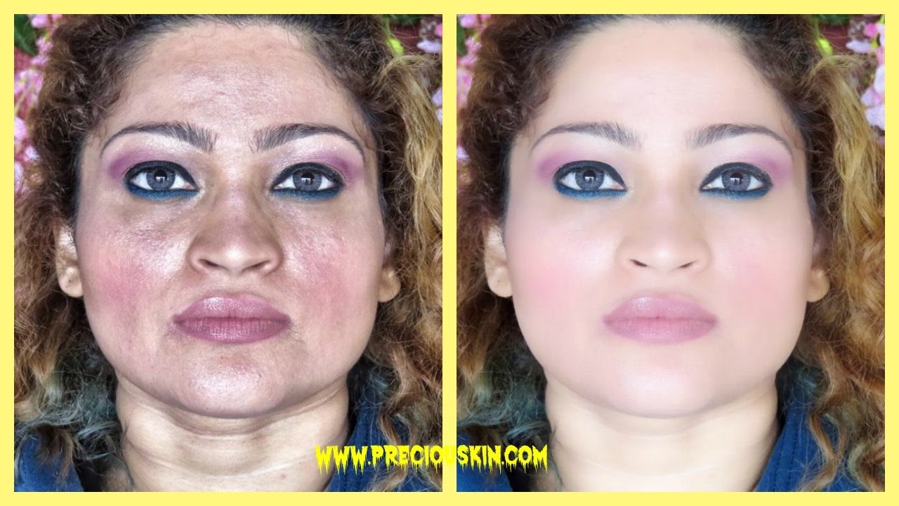 pigmentation lightening cream