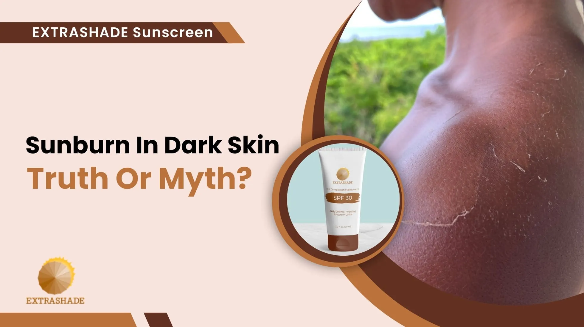 Sunburn In Dark Skin Truth Or Myth