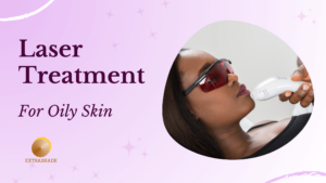 laser treatment for oily skin