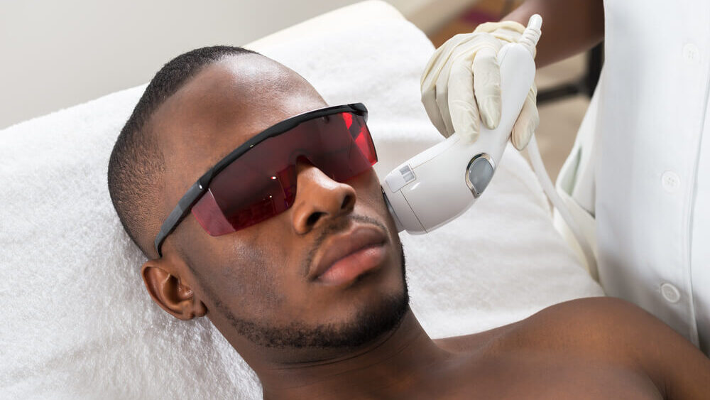 Laser treatment for oily skin - how does it work?