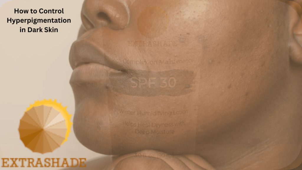 How To Control Hyperpigmentation In Dark Skin-Know The Secrets | EXTRASHADE
